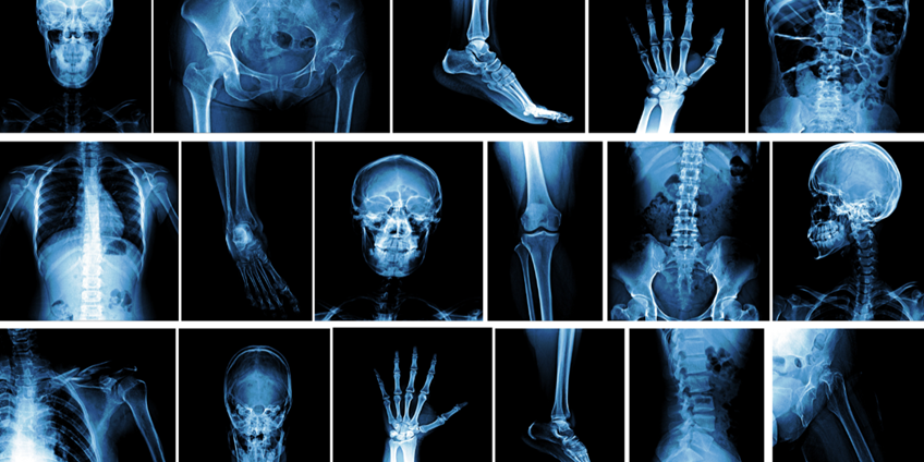 X-Ray Development from TeslaΓÇÖs Experiments